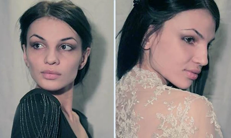 Марине Кушховой было 29, и она мечтала исправить форму носа. Девушка стала одной из трех жертв стационара «Медланж».