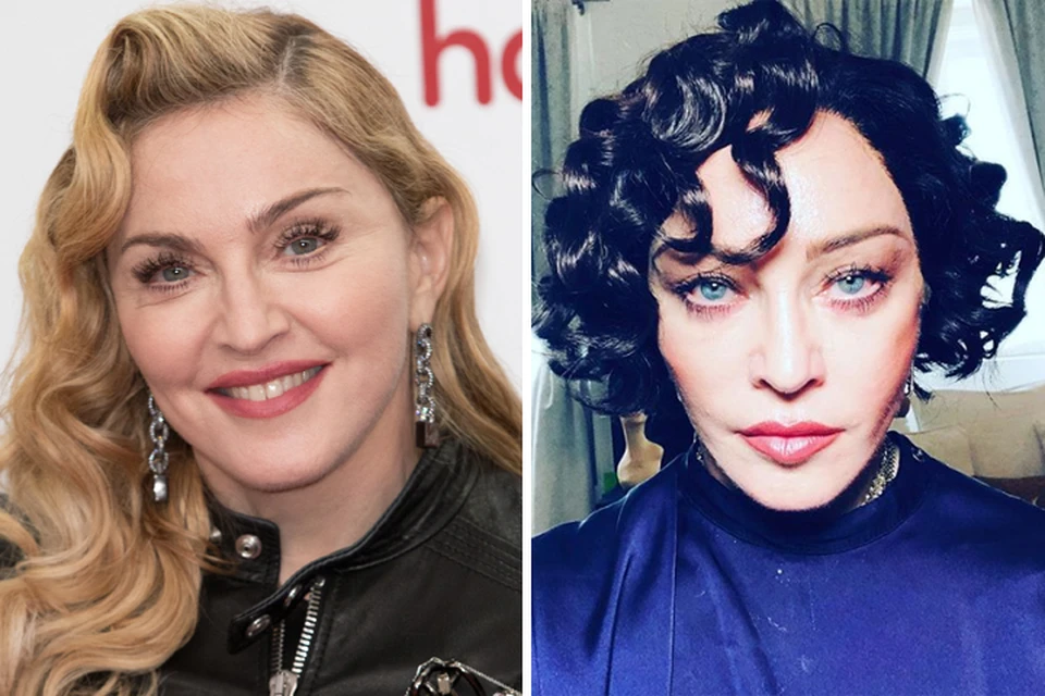 Еще недавно лицо Мадонны выглядело гораздо более пухлым (слева), чем на ее последних селфи (справа).
