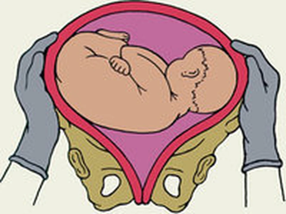 Беременность: что вы чувствуете, когда ребенок переворачивается головкой вниз? B