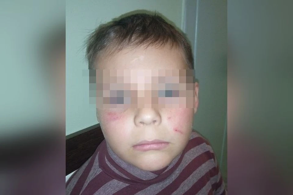 В Новосибирске девятилетнего мальчика избила толпа школьников на футбольном поле.