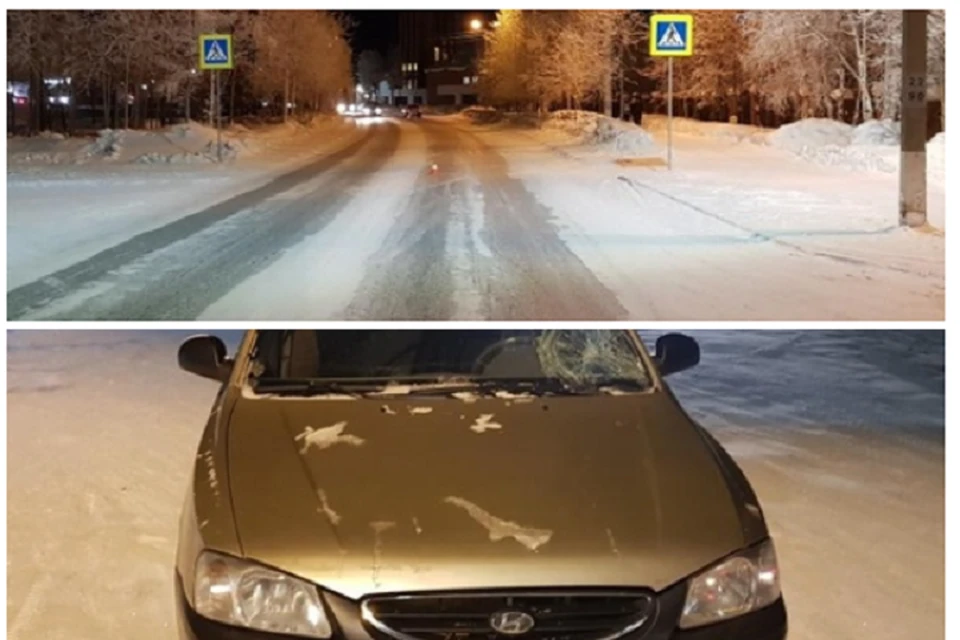 В Ноябрьске пешеход попал под колеса иномарки Фото: Госавтоинспекция Ямала