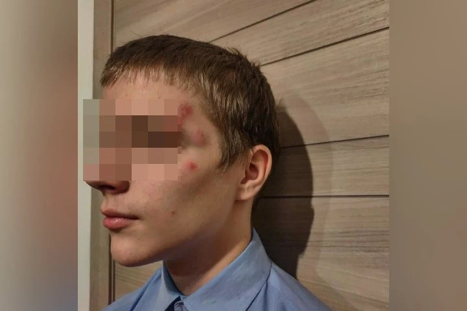 Подростка избили в центре Новосибирска. Фото: Ростислав Антонов
