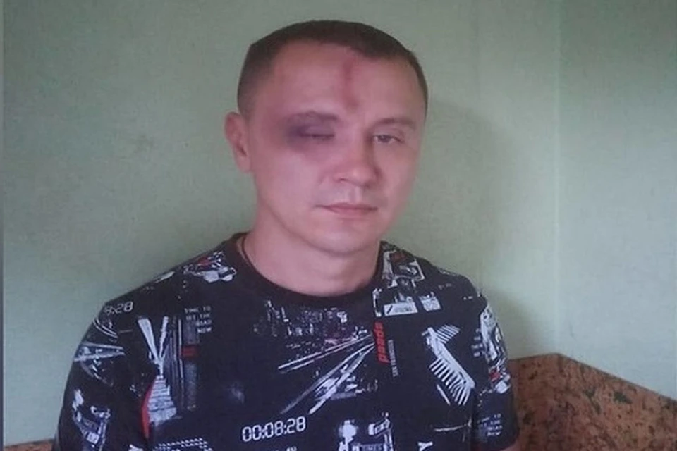 После избиения дружинника возбудили уголовное дело. Фото: предоставлено Ростиславом Антоновым