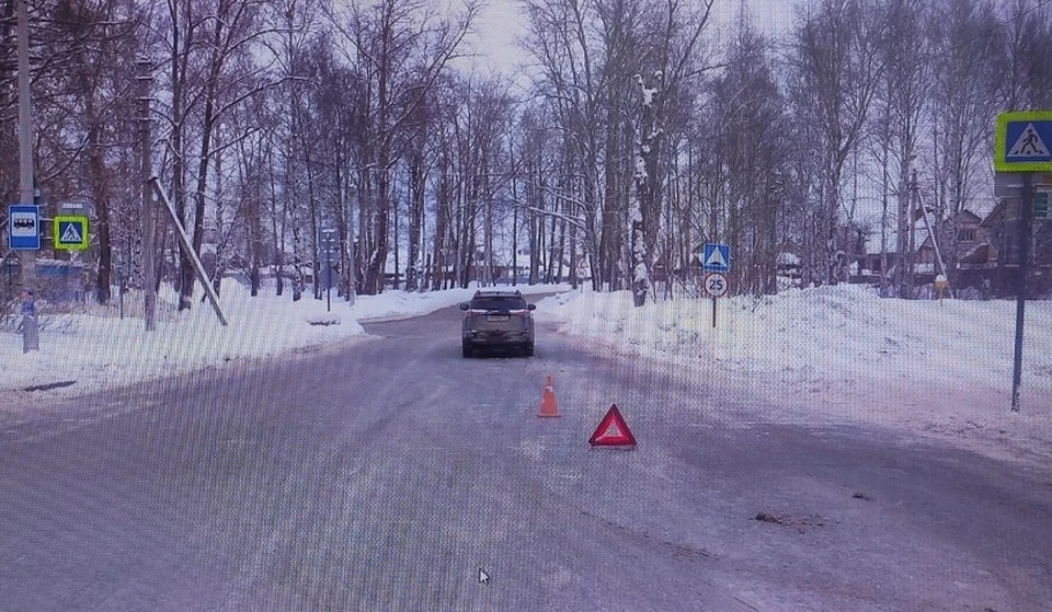 Автомобиль сбил ребенка на пешеходном переходе. Фото: УГИБДД по Пермскому краю.