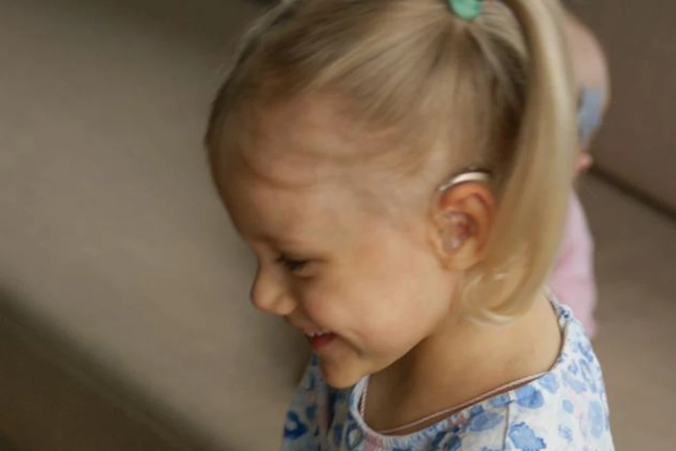 Девочка может слышать только с помощью специальных имплантов. Фото: Личный архив героев публикации