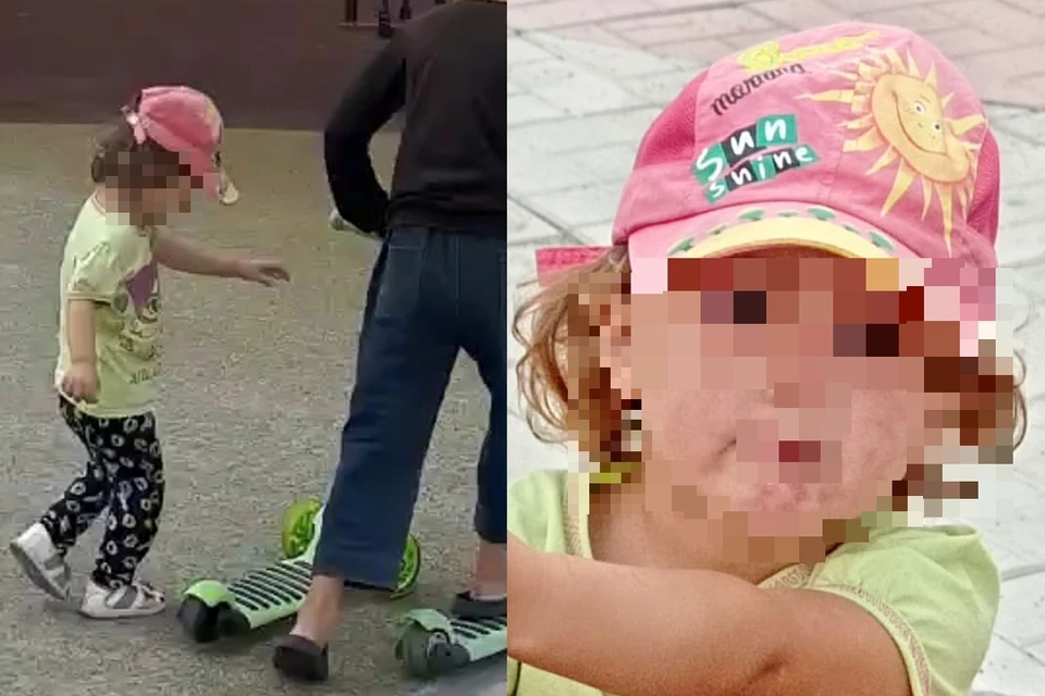 Девочка с пятнами на лице напугала родителей. Фото: Предоставлено местными жителями