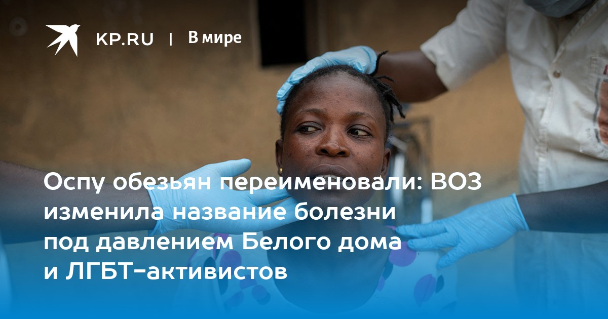 Оспу обезьян переименовали: ВОЗ изменила название болезни под давлением Белого дома и ЛГБТ-активистов