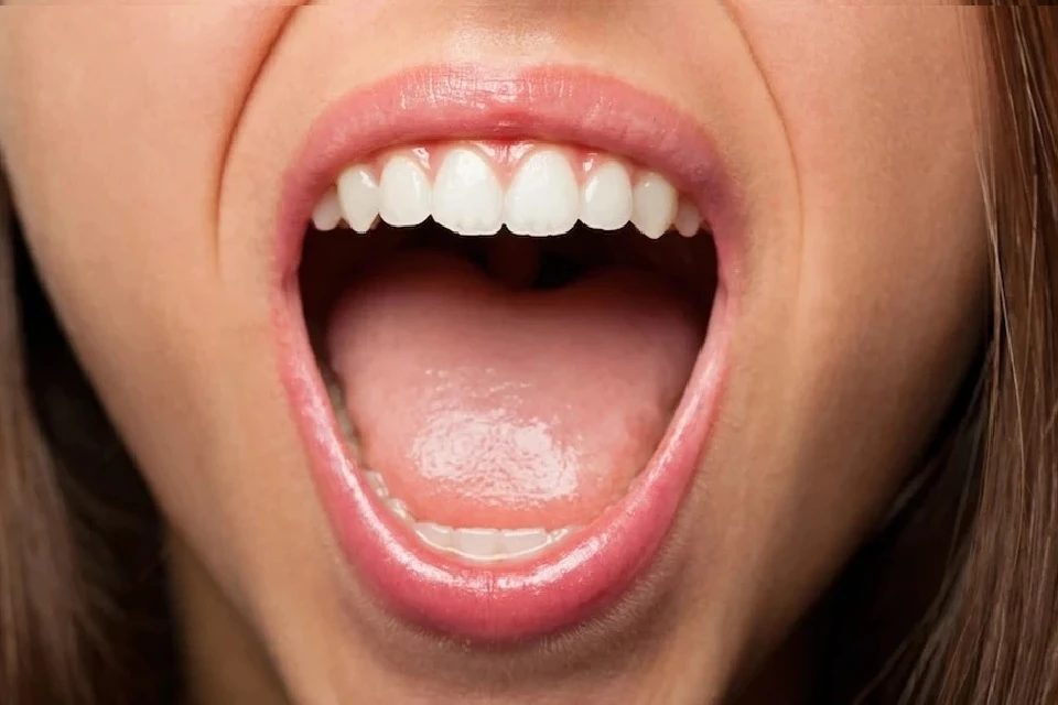 Из-за весеннего дефицита витаминов могут опухать язык и кровоточить десны Фото: freepik.com