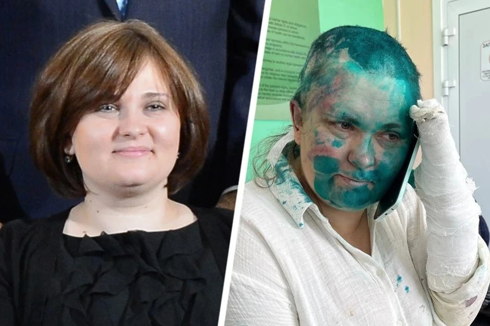 Журналистка Елена Милашина до и после нападения. Фото: тг-канал Ксении Собчак
