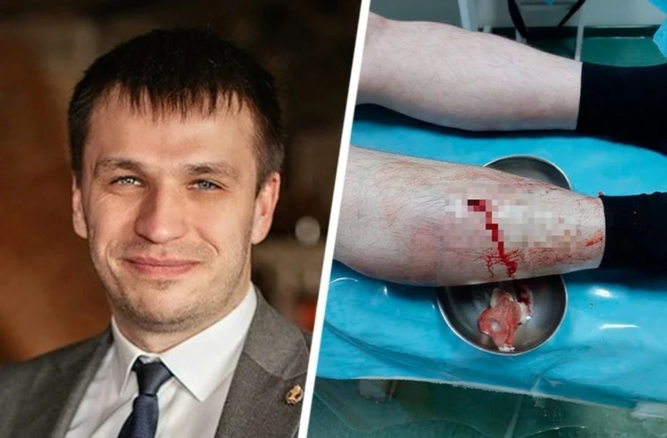 Александру Немову порезали ногу.