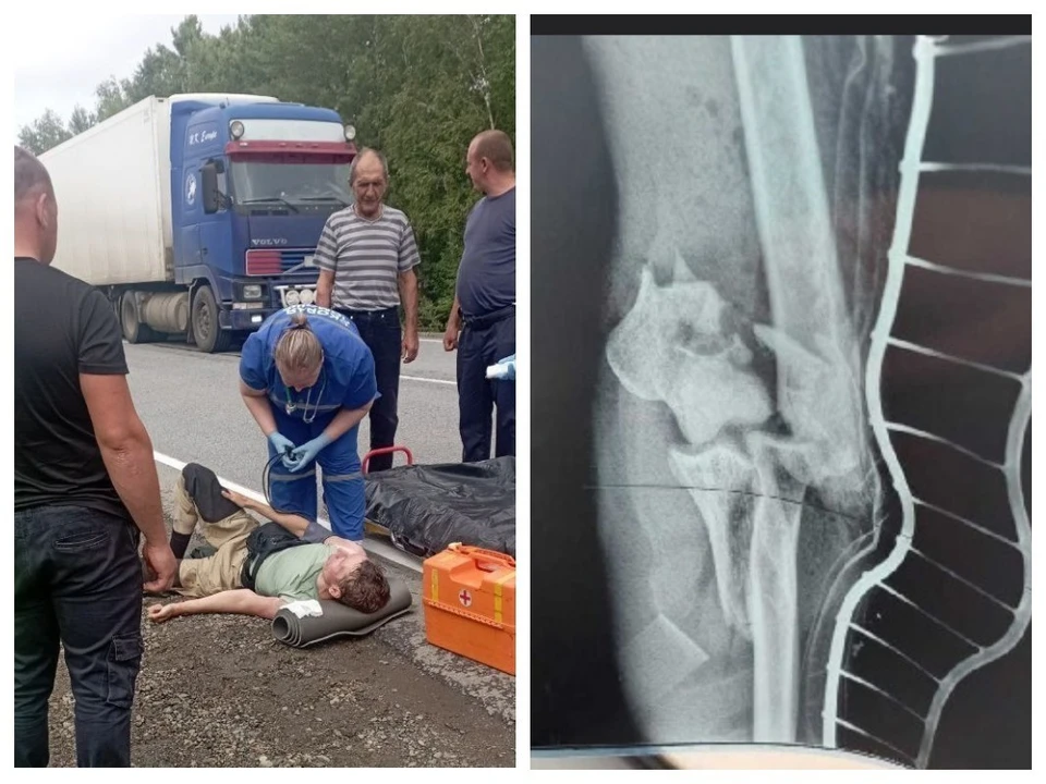 Якутянин, которого на трассе "Уссури" сбил грузовик, рассказал подробности ДТП. Фото: «Аргументы и факты - Хабаровск» / SakhaDay