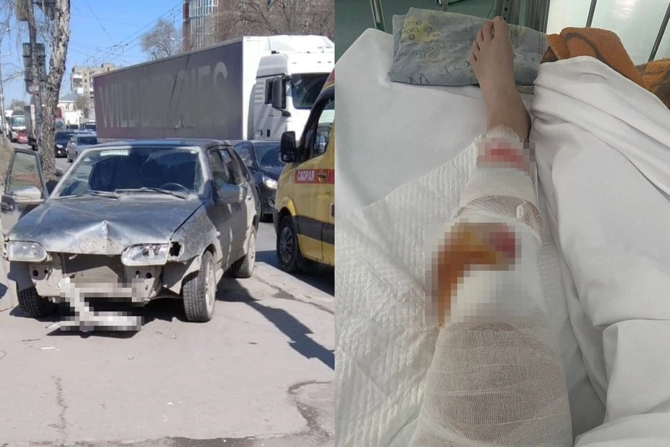 Авто сбило сибирячку и серьезно повредило женщине ногу. Фото: предоставлено героиней публикации.