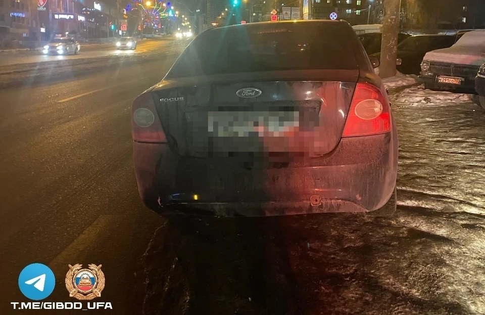 В ДТП пешеход — 58-летняя женщина — с травмой ноги была доставлена в больницу