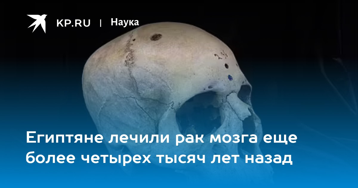Египтяне лечили рак мозга еще более четырех тысяч лет назад
