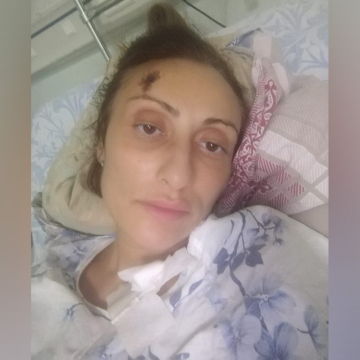 раздвинула ноги серьезная Умоляла врачей оставить мне ноги»: Сбитая иномаркой в центре Краснодара  женщина вышла на связь из больницы - KP.RU