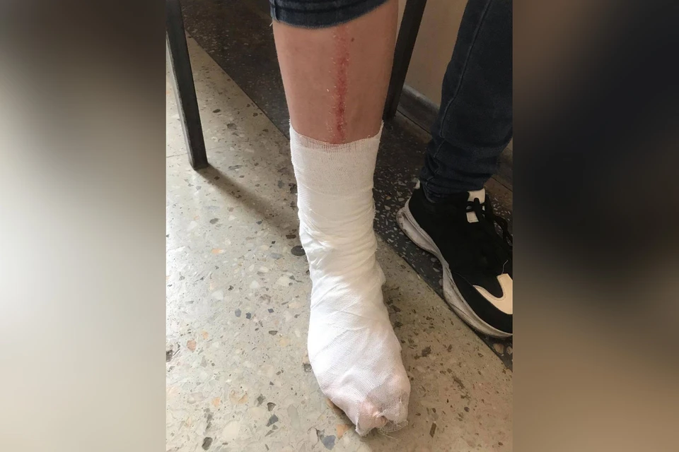 Девочка получила перелом ноги. Фото: прокуратура Челябинской области