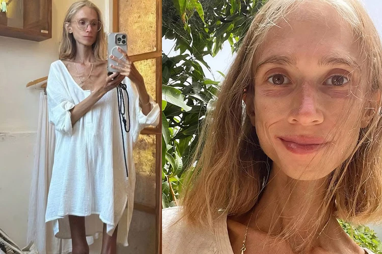 Весила 23 килограмма: евшая только фрукты туристка умерла на Бали
