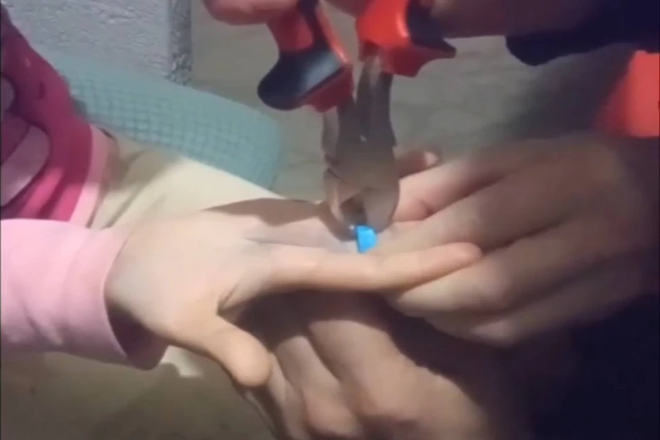 Спасатели освободили палец ребёнка из пластикового гаечного ключа. Фото: спасатели МАСС