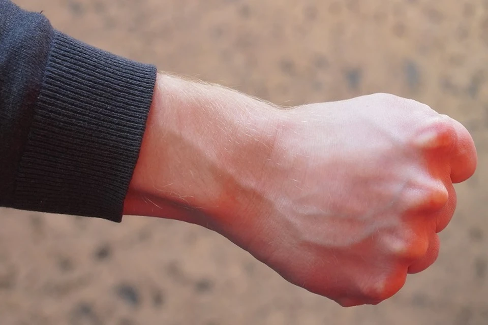 Избил жену и получил два с половиной года ограничения свободы житель Магадана