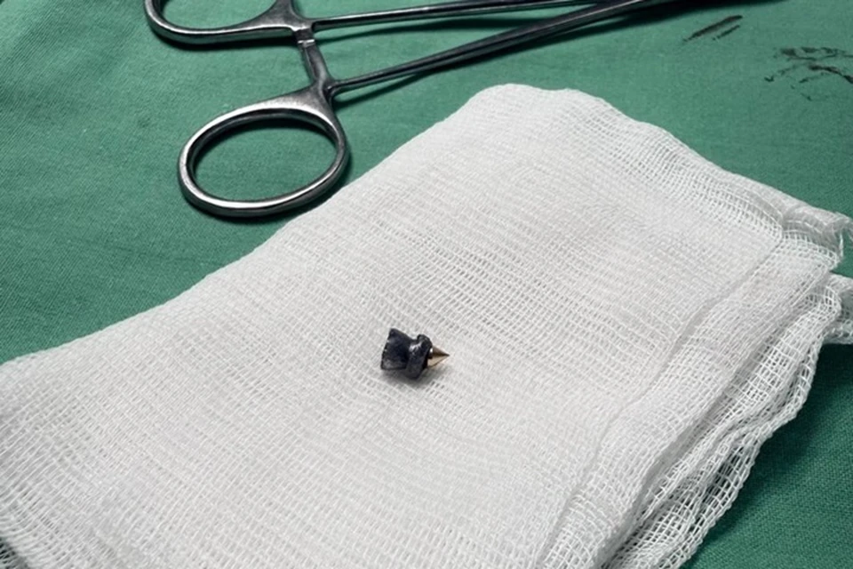 Вытащенная из шеи пуля. Фото: РКБ Татарстана