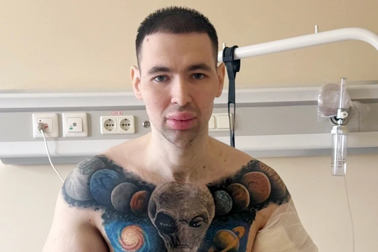 Ампутация, некрозы и многочисленные операции: что грозит блогеру «Руки-Базуки» Кириллу Терёшину