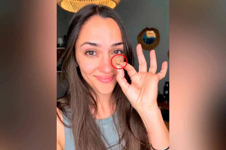 Девушка 35 лет прожила с комком скотча в носу, оставленным там в роддоме