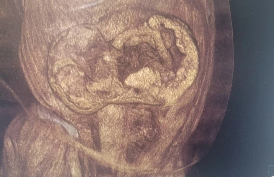 фото БСМП №8