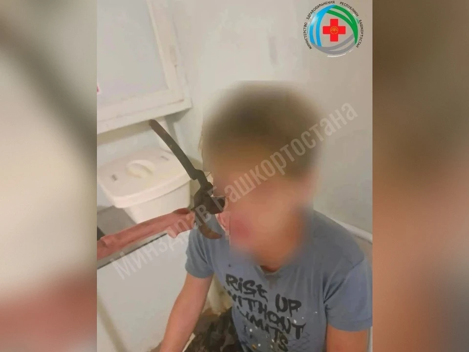 Хирурги провели сложную операцию подростку после несчастного случая.