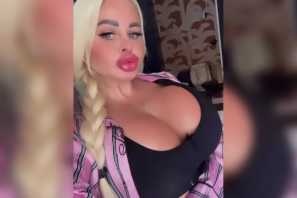 Анна Данилова осталась довольна результатом операции. Фото: скриншот видео