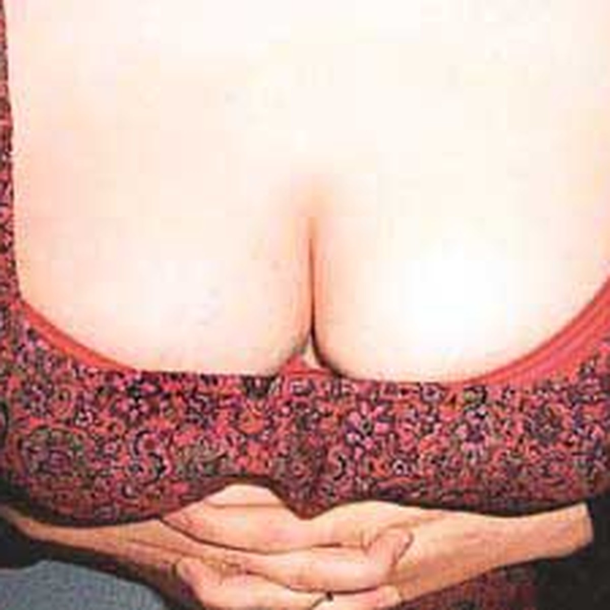 форум женщин с кистой груди фото 14
