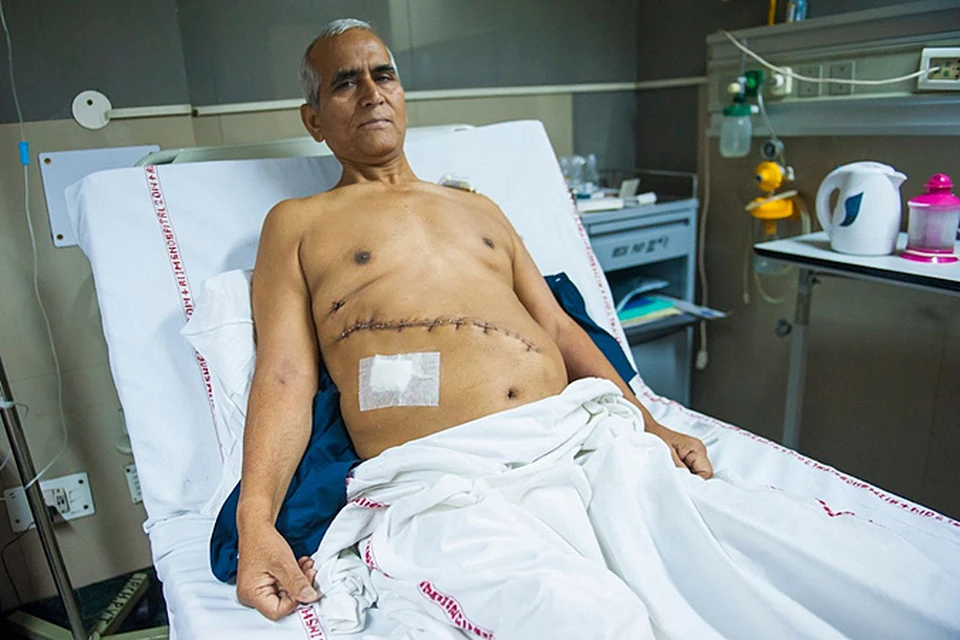 Хирурги Всеиндийского института медицинских наук в Дели провели уникальную операцию